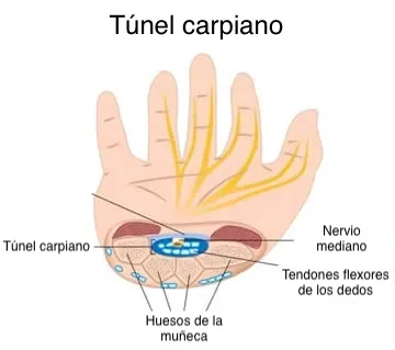 Ilustración de la anatomia del túnel carpiano